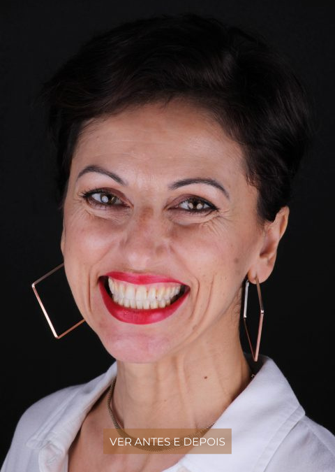 Um novo sorriso com a ClearCorrect®