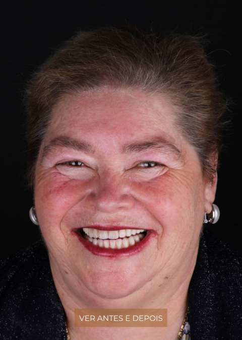 A harmonia de um sorriso após os 65 anos