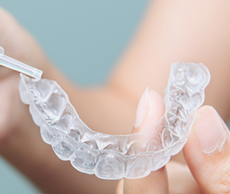 Apenas um dente escurecido? Branqueamento interno