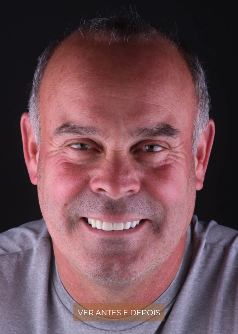 Joaquim Fonseca