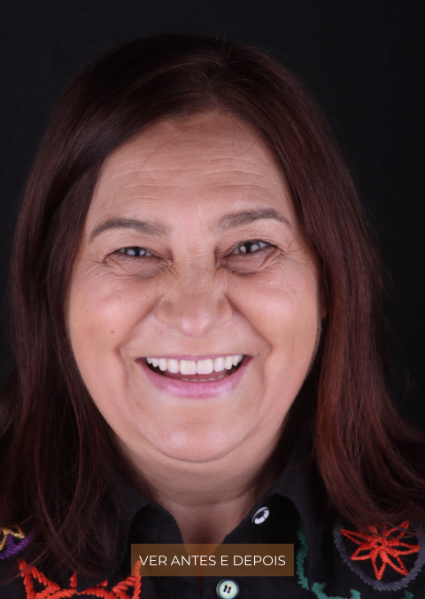 Lurdes Fernandes