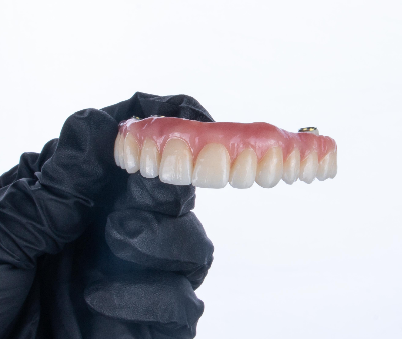 3 questões frequentes sobre Dentes Fixos em 1 Dia
