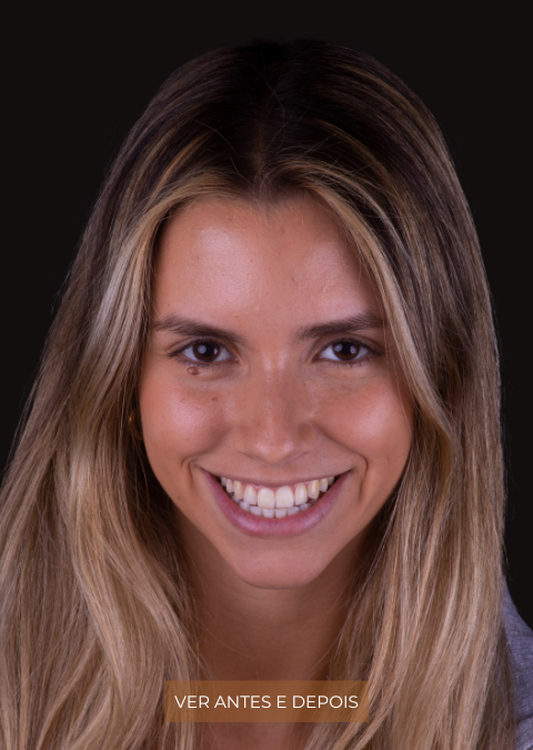 Joana Rebelo
