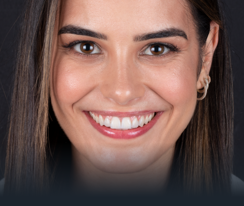 Diastema (dentes separados) como resolver?